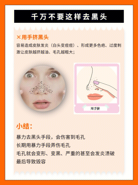 挤黑头最新方法与注意事项详解